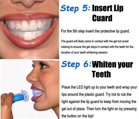 How To Use Teeth Whitening Kit Teeth Poster