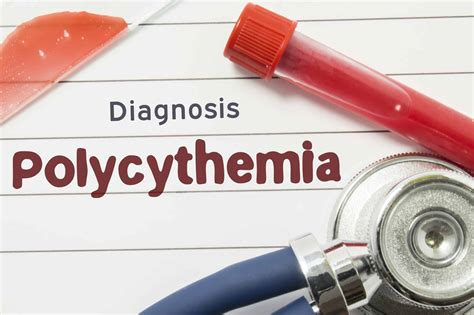 Polycythemia Vera Symptoms When Blood Becomes Thicker