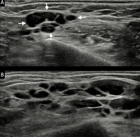 Safety Patient Acceptance And Diagnostic Accuracy Of Ultrasound Core
