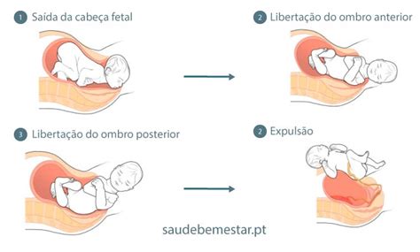 Parto Normal Saiba Tudo Sobre O Antes Durante E Após O Parto