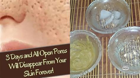 3 Home Remedies For Open Pores How To Get Rid Of Large Open Pores
