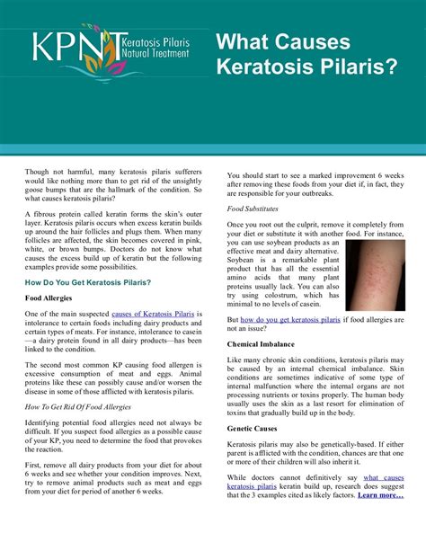What Causes Keratosis Pilaris