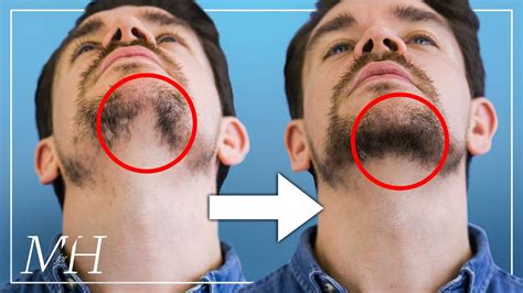Top 148 Facial Hair Problems And Solutions Polarrunningexpeditions