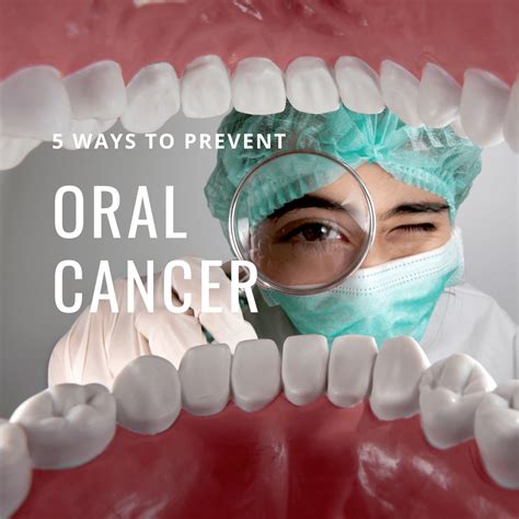 5 Ways To Prevent Oral Cancer Mclean Va Smile Mclean Dentistry