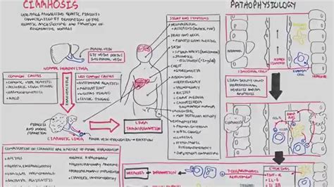 Destruction in liver parenchyma, separation of lobules by fibrous tissue, development of abnormal structured nodules, and abnormal vascular architecture. Liver Cirrhosis (SandS, Pathophysiology, Investigations ...