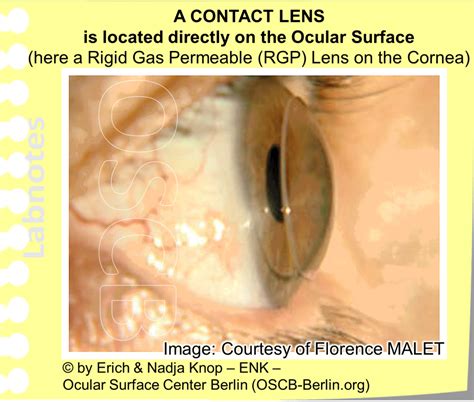 Deeper Insight Into Contact Lenses History Types Schedules