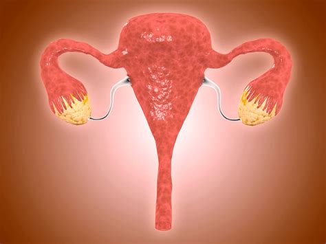 Pcos What Are The Symptoms Of Polycystic Ovary Syndrome And How Is It