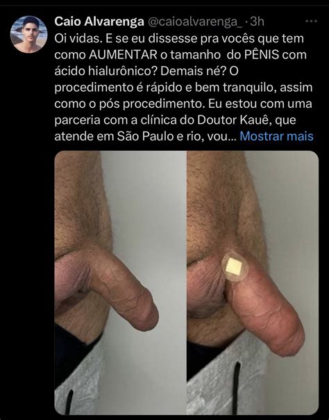 Gui Prado on Twitter Que bizarrice é essa gente O pior é que não