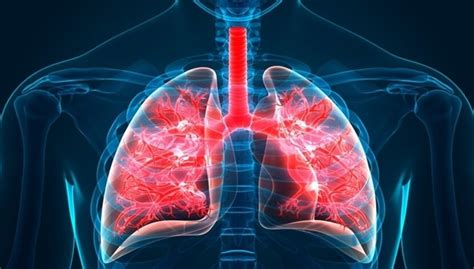 Pulmonary Fibrosis Increases The Risk Of Contracting Coronavirus Elg Law