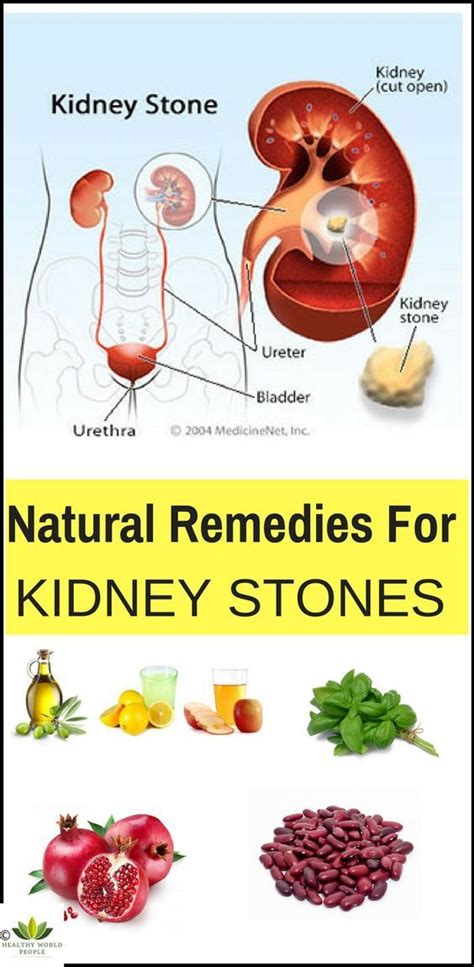 Here Are Few Recipes That Can Help You In Prevention Of Kidney Stones