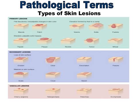 Skin lesion information including symptoms, diagnosis, treatment, causes, videos, forums skin lesions can be singular or multiple, confined to one specific area of your body or distributed widely. Medical Terminology Chapter 4