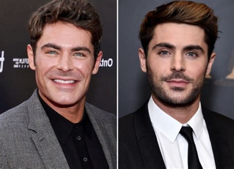 Zac Efron Plastic Surgery Accident Even After Getting Her Jaw Injured