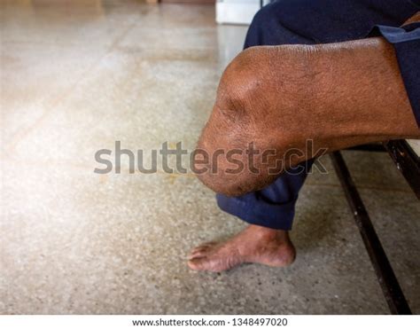 Men Cut Legs Under Knee Legs Stock Photo Edit Now 1348497020