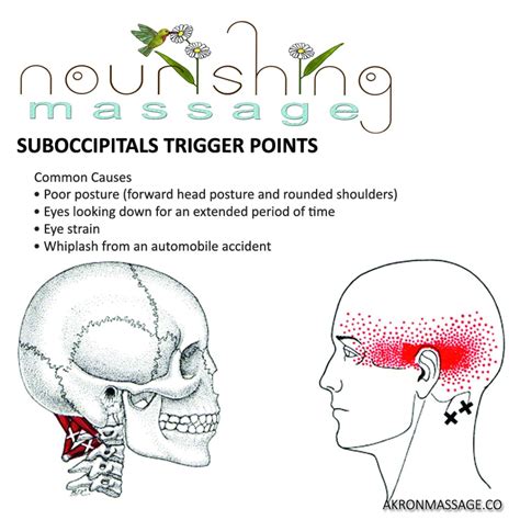 Suboccipital Trigger Point Release And Stretch Nourishing Massage
