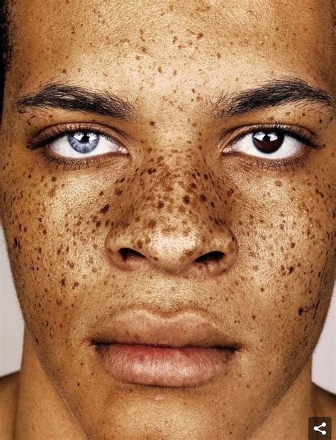 How To Get More Freckles On Face Nose And Cheeks Are Two Most
