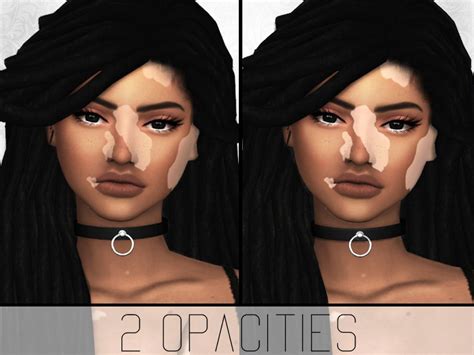 Simplypixelated Vitiligo Overlay The Sims 4 Catalog