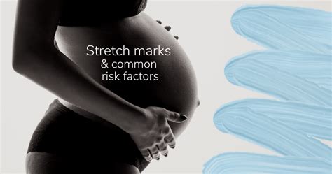 Stretch Marks And Common Risk Factors My Lilli Pilli