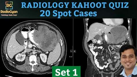 Radiology Quiz Kahoot 20 Radiology Cases Radiogyan