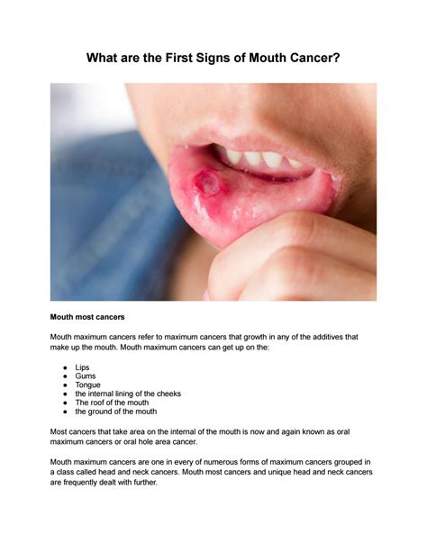 What Are The First Signs Of Mouth Cancer By Bruceaustin04 Issuu