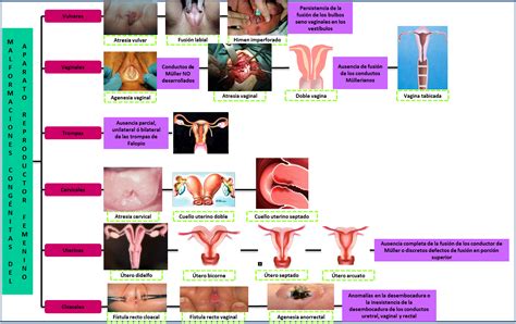 Mapas Mentales Sobre El Aparato Reproductor Femenino Cuadro Comparativo