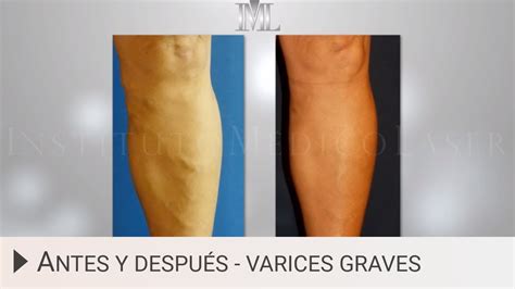 Simple Science: How to Make a Volcano with Kids