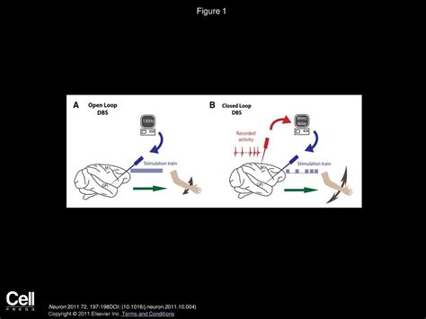 Stimulation On Demand Closing The Loop On Deep Brain Stimulation Ppt