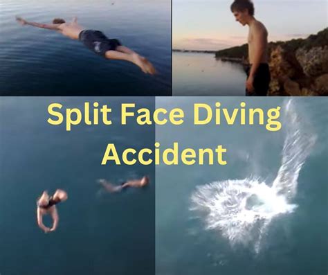 Split Face Diving Accident Split Face Diving Accident Full Video