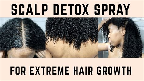 Diy Clarifying Scalp Spray For Maximum Hair Growth Youtube