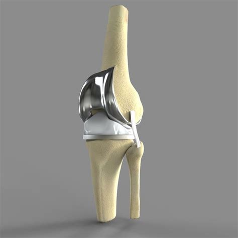 An Image Of A Medical Device In The Shape Of A Knee And Leg With A Large Bone Attached To It