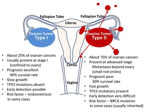 Ovarian Cancer Silent And Deadly Atlas Of Science
