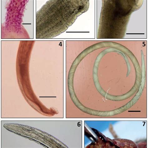 Helminth Eggs And Larva And The Protozoan Blood Parasite Found Scale