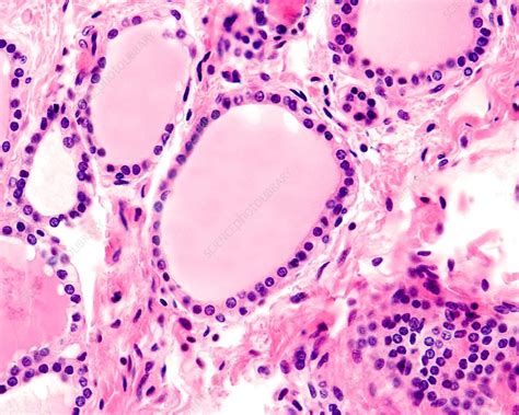 Human Thyroid Gland Light Micrograph Stock Image C0545843