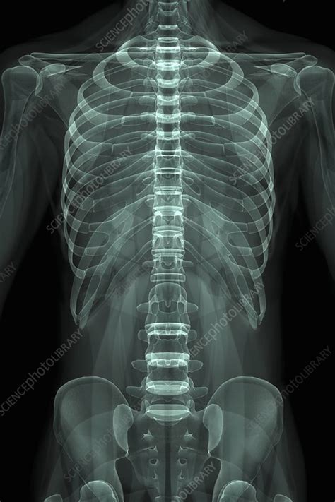 Bones Of The Torso Artwork Stock Image C0202790 Science Photo