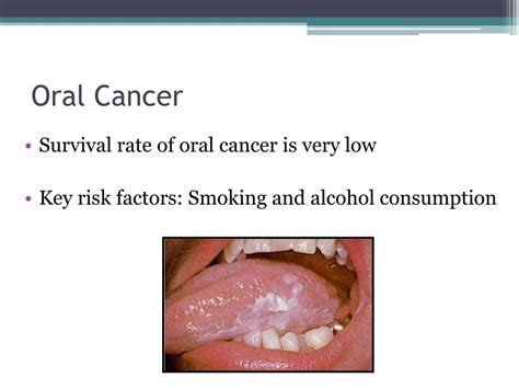 Ppt The Oral Systemic Link Powerpoint Presentation Free Download