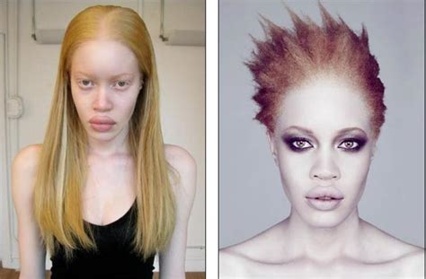 Albino Black People Model Diandra Forrest African American Beauty Bio