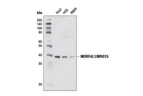 Morf4l1mrg15 Antibody Cell Signaling Technology