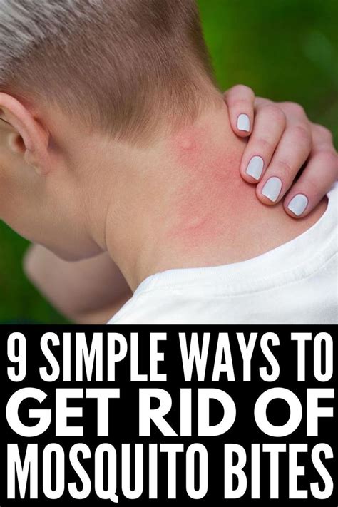 Stop The Itch 9 Natural Mosquito Bite Remedies That Work Remedies