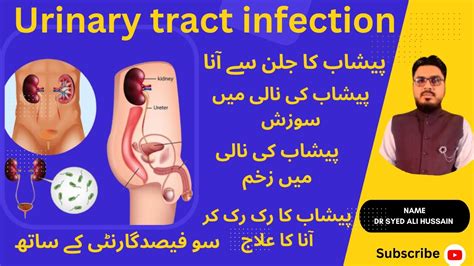 Peshab Ki Nali Ki Jalan Ka Ilaj Uti 10 Home Remedies For Urinary Tract Infection In Urdu
