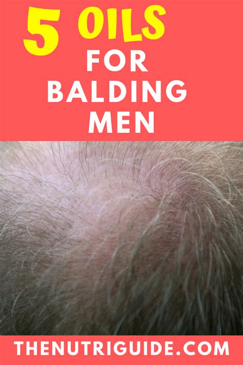 How To Reduce Baldness Naturally A Comprehensive Guide Best Simple