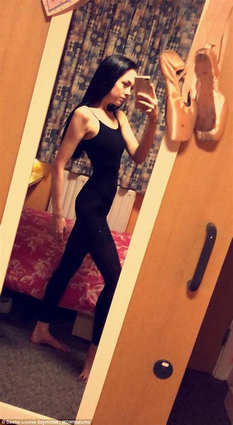 Anorexia Dancer Survived On Calories A Day Daily Mail Online