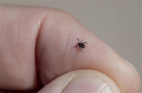Over 14 Of World Has Had Lyme Disease Study