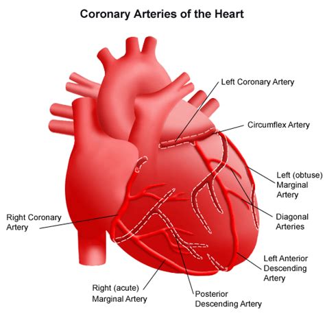 Anomalous Coronary Artery Stanford Health Care