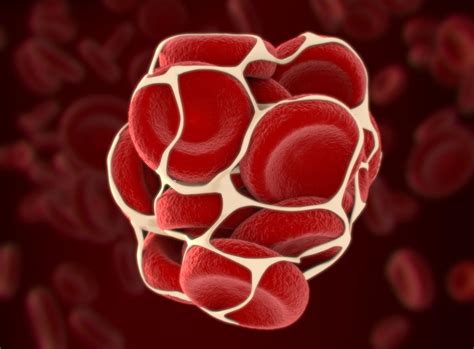 Symptoms and signs of a blood clot include. Deep vein thrombosis and pulmonary embolism: Risk factors ...
