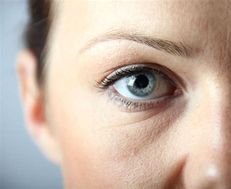 Everything To Know About Different Kinds Of Under Eye Skin Problems
