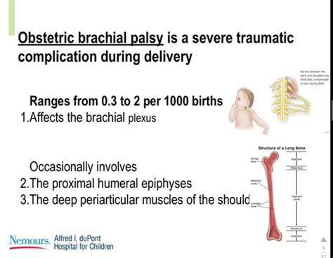 Obstetric Brachial Plexus Injury Flashcards Quizlet
