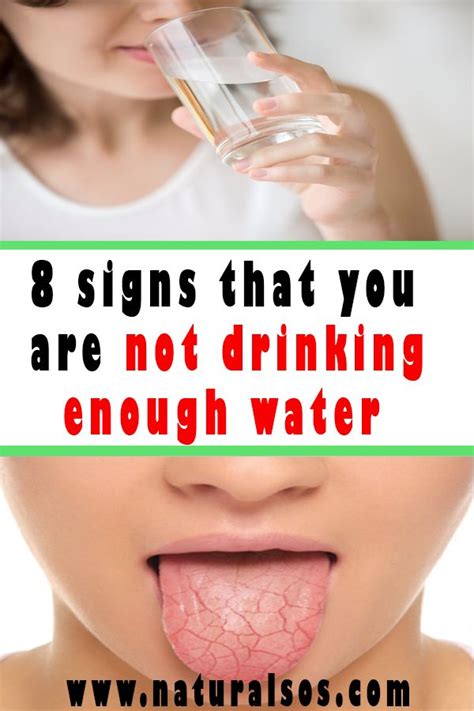 8 Signs That You Are Not Drinking Enough Water Not Drinking Enough