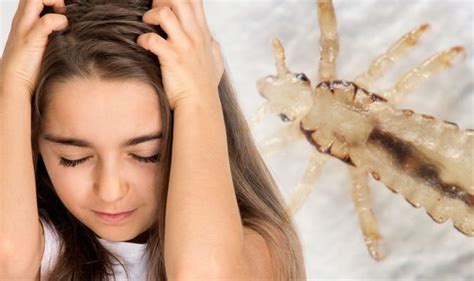 What Blood Types Affect Lice The Most Lice Free Ny