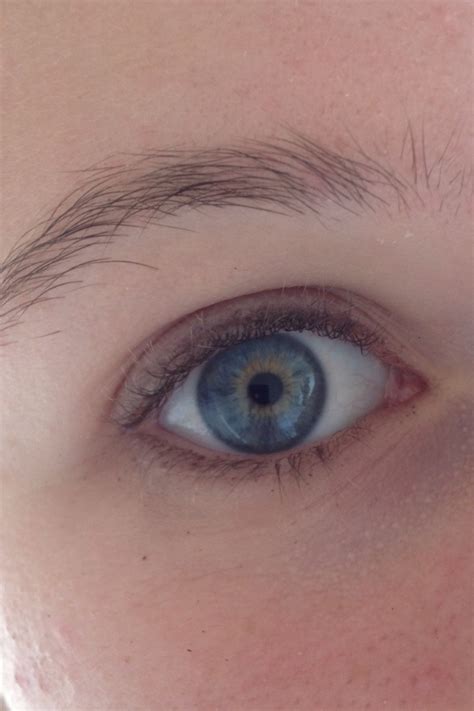 Best Central Heterochromia Images On Pholder Eyes Heterochromia