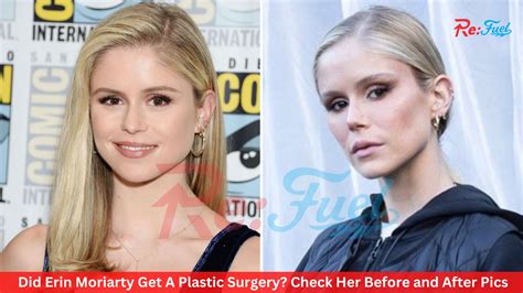 Did Erin Moriarty Get Plastic Surgery Check Her Before And After Pics Fitzonetv