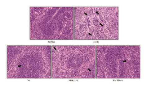 Hande Pathological Observation Of Spleen In Mice Magnification 100× Vc